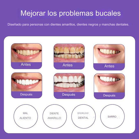 BLANQUEADOR DENTAL HISMILE ®