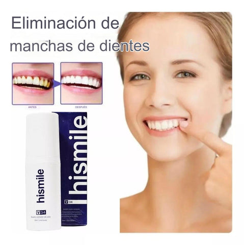 BLANQUEADOR DENTAL HISMILE ®