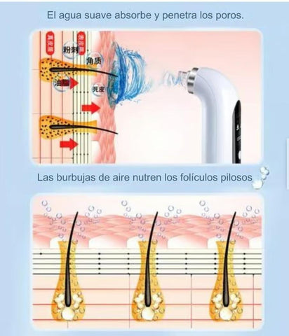 Extractor de Espinillas con Líquido